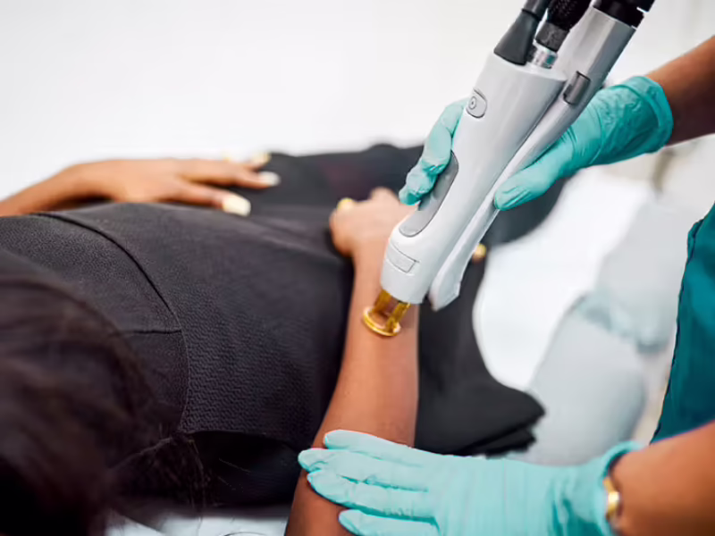 woman-getting-laser-treatment-732x549-thumbnail-732x549